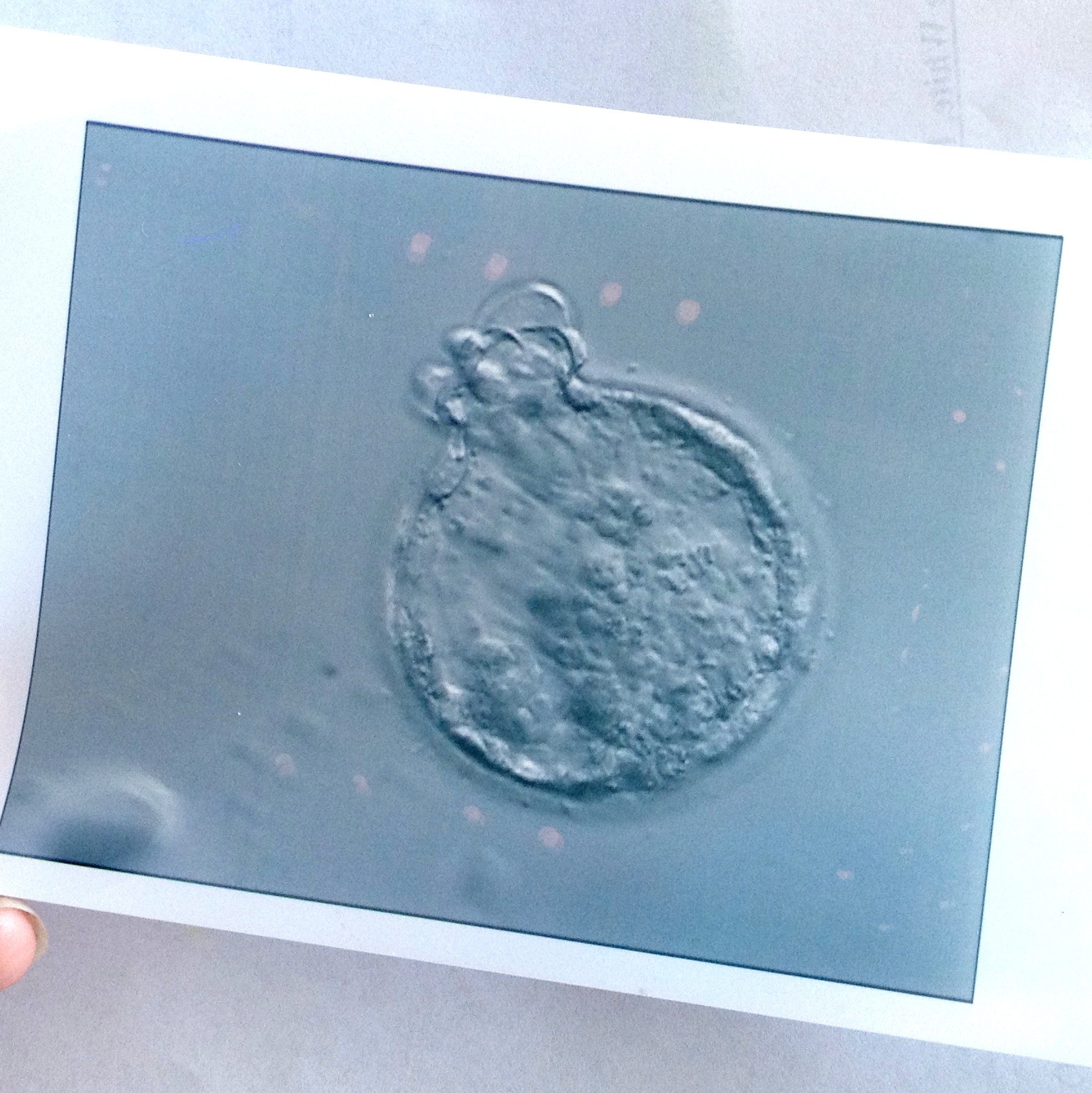 Kinda Pregnant | Reality Daydream